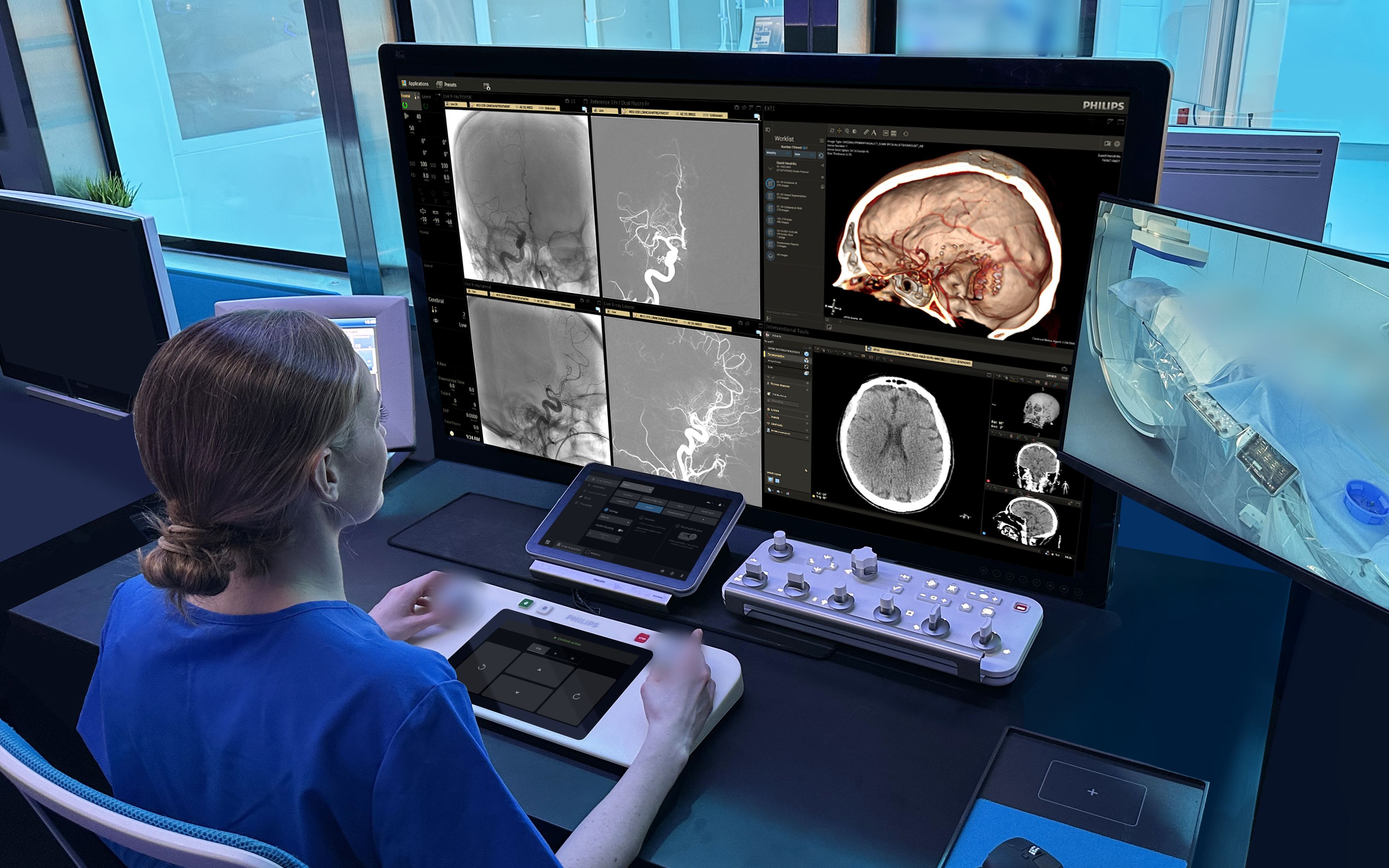 Philips wins $33.7m ARPA-H award for AI robotic stroke care