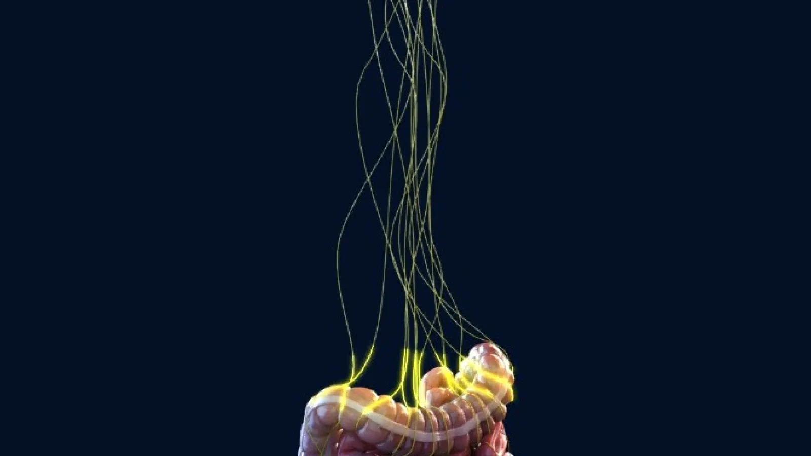 Vibrant Gastro capsule used in JAMA Psychiatry gut-brain study