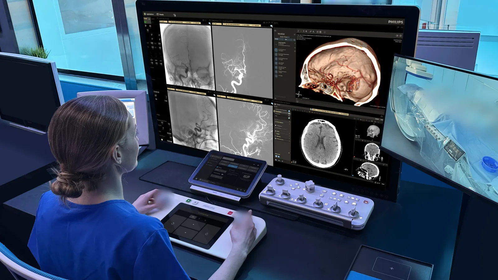 Philips wins $33.7m ARPA-H award for AI robotic stroke care