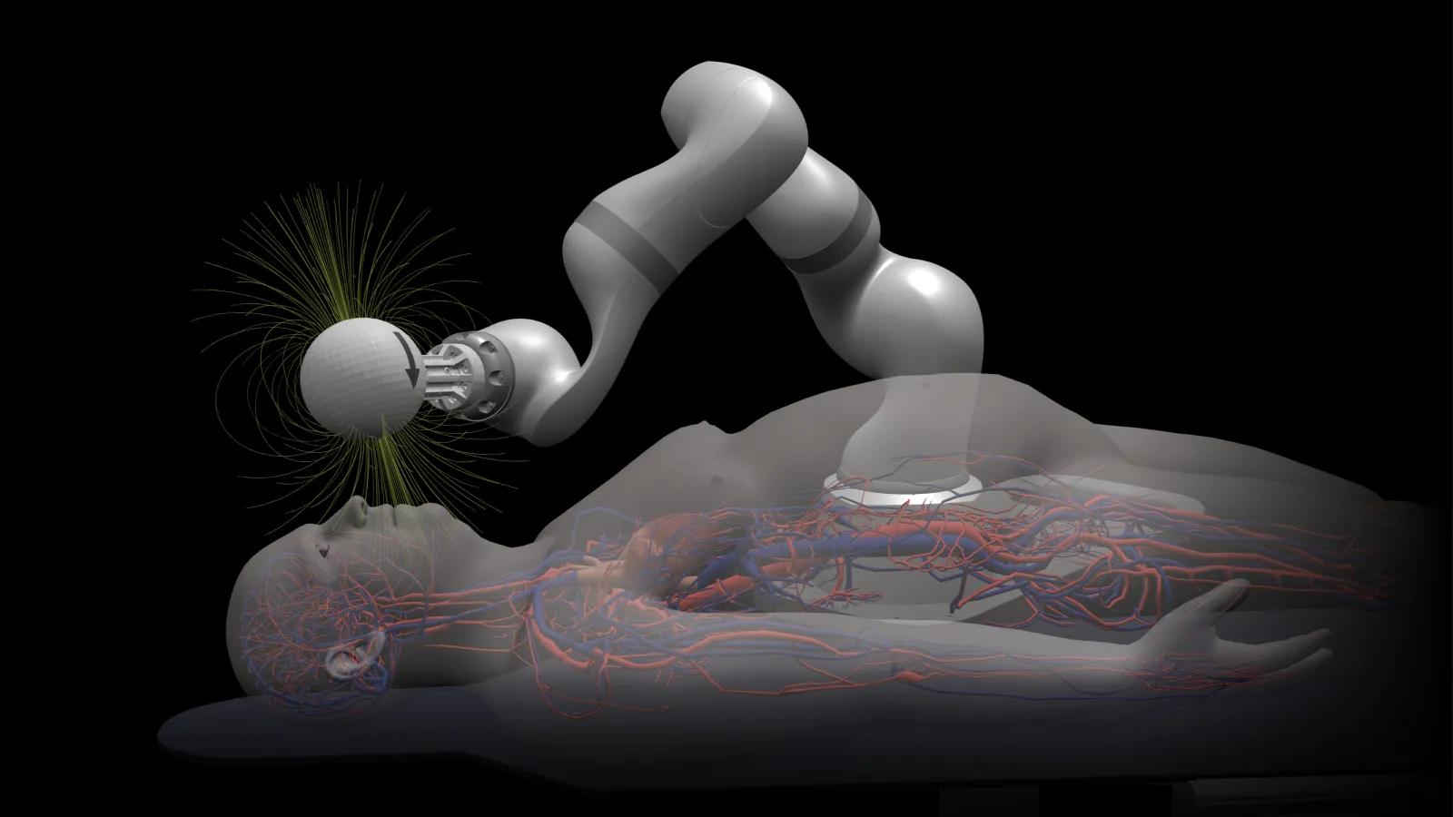 Magnendo wins up to $32m ARPA-H grant for autonomous stroke robot