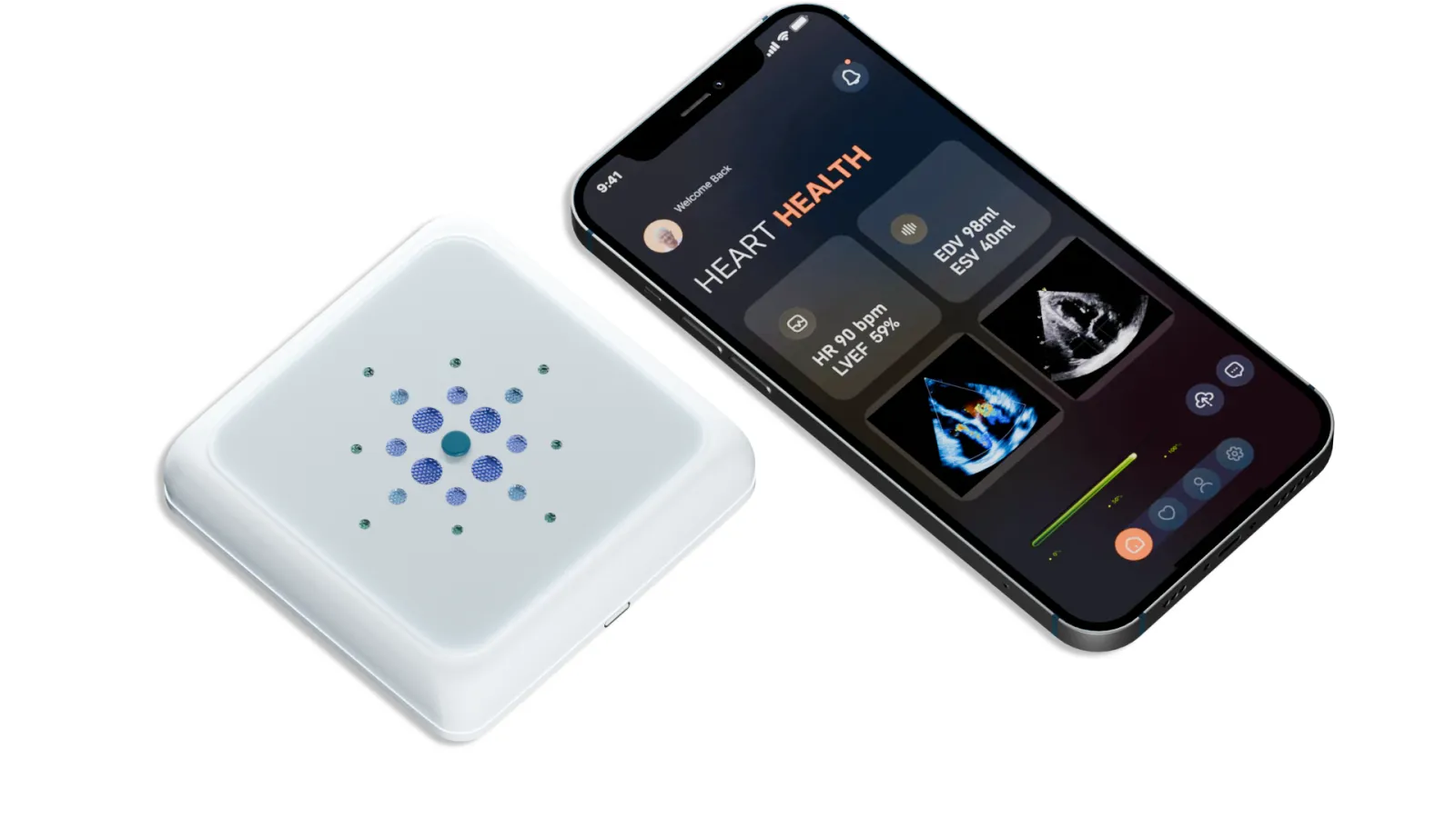 Sonus Microsystems and Medtronic partner on AI wearable for preeclampsia
